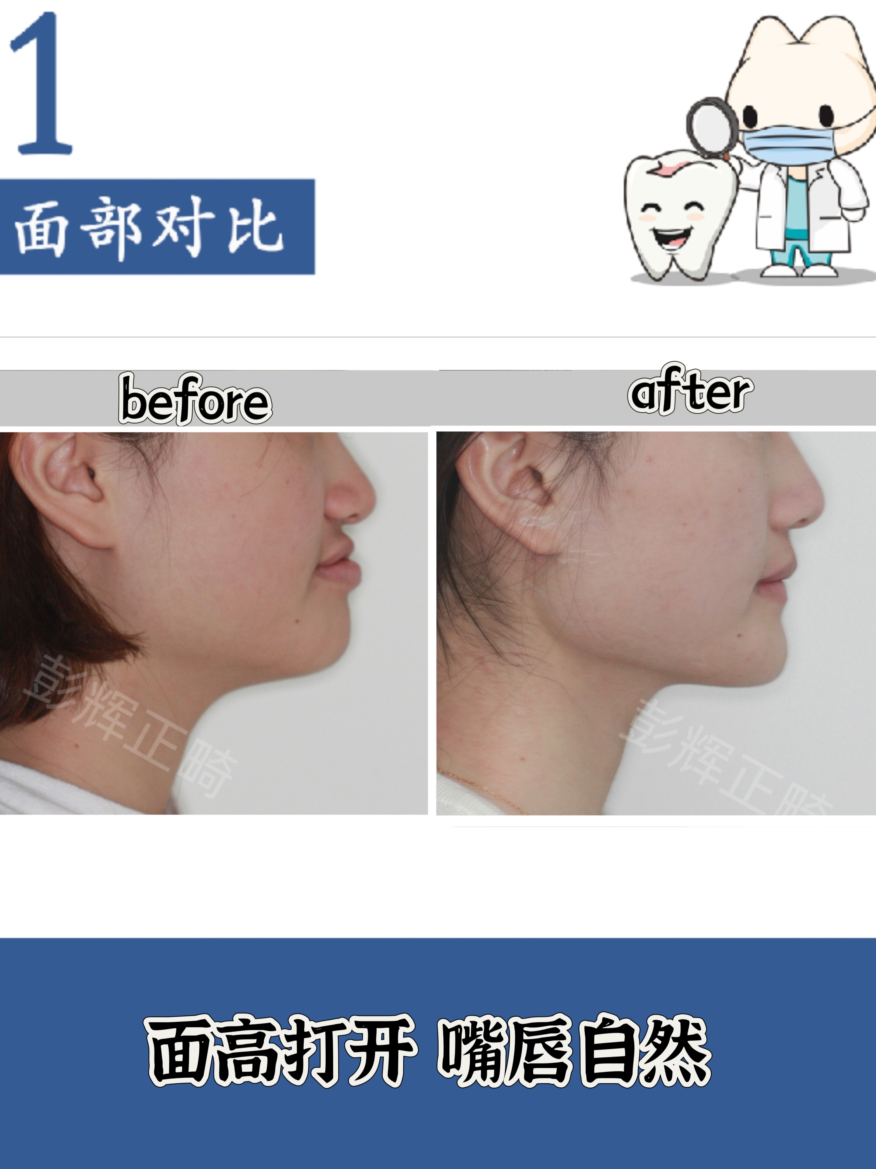 bpdkpi区别 bpsk与dpsk区别 